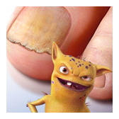 Toenail fungus